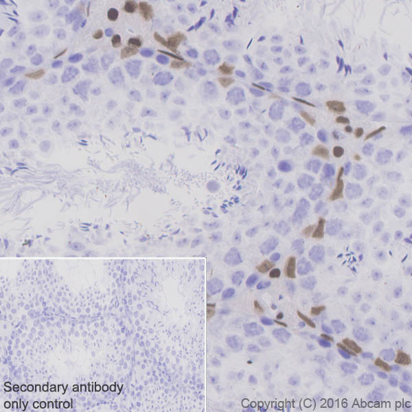 Immunohistochemistry (Formalin/PFA-fixed paraffin-embedded sections) - Anti-Androgen Receptor antibody [EPR1535(2)] (ab133273), expandable thumbnail