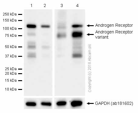 Western blot - Anti-Androgen Receptor antibody [EPR1535(2)] (ab133273), expandable thumbnail