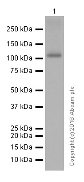 Western blot - Anti-Androgen Receptor antibody [EPR1535(2)] (AB133273), expandable thumbnail