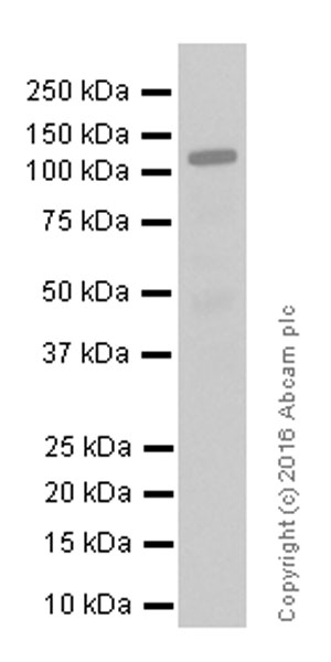 Western blot - Anti-Androgen Receptor antibody [EPR1535(2)] (ab133273), expandable thumbnail