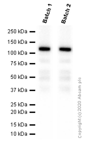 Western blot - Anti-Androgen Receptor antibody [EPR1535(2)] (ab133273), expandable thumbnail