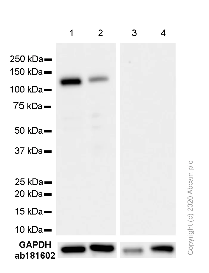 Western blot - Anti-Androgen Receptor antibody [EPR1535(2)] (AB133273)