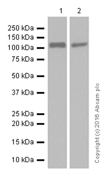 Western blot - Anti-Androgen Receptor antibody [EPR1535(2)] (ab133273), expandable thumbnail