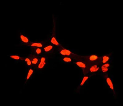 Immunocytochemistry/ Immunofluorescence - Anti-Androgen Receptor antibody [EPR1535(2)] - Low endotoxin, Azide free (AB209969)