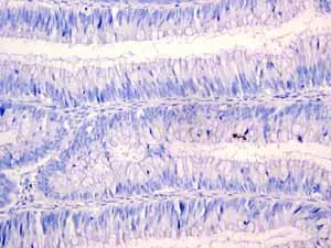 Immunohistochemistry (Formalin/PFA-fixed paraffin-embedded sections) - Anti-Androgen Receptor antibody [EPR1535(2)] - Low endotoxin, Azide free (AB209969)