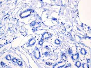 Immunohistochemistry (Formalin/PFA-fixed paraffin-embedded sections) - Anti-Androgen Receptor antibody [EPR1535(2)] - Low endotoxin, Azide free (AB209969)