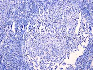 Immunohistochemistry (Formalin/PFA-fixed paraffin-embedded sections) - Anti-Androgen Receptor antibody [EPR1535(2)] - Low endotoxin, Azide free (AB209969)