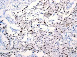 Immunohistochemistry (Formalin/PFA-fixed paraffin-embedded sections) - Anti-Androgen Receptor antibody [EPR1535(2)] - Low endotoxin, Azide free (AB209969)
