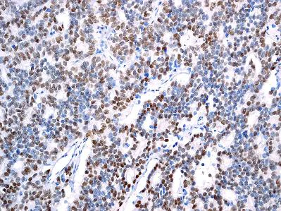 Immunohistochemistry (Formalin/PFA-fixed paraffin-embedded sections) - Anti-Androgen Receptor antibody [EPR1535(2)] - Low endotoxin, Azide free (AB209969)