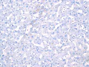 Immunohistochemistry (Formalin/PFA-fixed paraffin-embedded sections) - Anti-Androgen Receptor antibody [EPR1535(2)] - Low endotoxin, Azide free (AB209969)