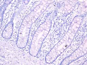 Immunohistochemistry (Formalin/PFA-fixed paraffin-embedded sections) - Anti-Androgen Receptor antibody [EPR1535(2)] - Low endotoxin, Azide free (AB209969)