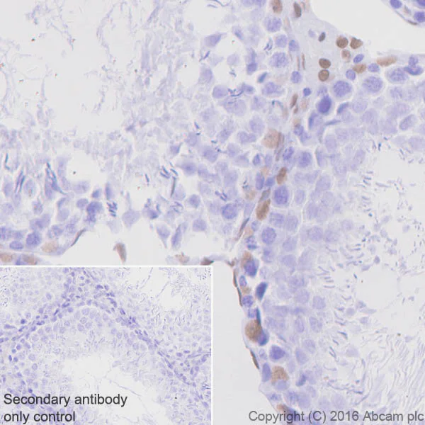 Immunohistochemistry (Formalin/PFA-fixed paraffin-embedded sections) - Anti-Androgen Receptor antibody [EPR1535(2)] - Low endotoxin, Azide free (AB209969)