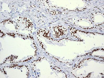 Immunohistochemistry (Formalin/PFA-fixed paraffin-embedded sections) - Anti-Androgen Receptor antibody [EPR1535(2)] - Low endotoxin, Azide free (AB209969)