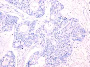 Immunohistochemistry (Formalin/PFA-fixed paraffin-embedded sections) - Anti-Androgen Receptor antibody [EPR1535(2)] - Low endotoxin, Azide free (AB209969)