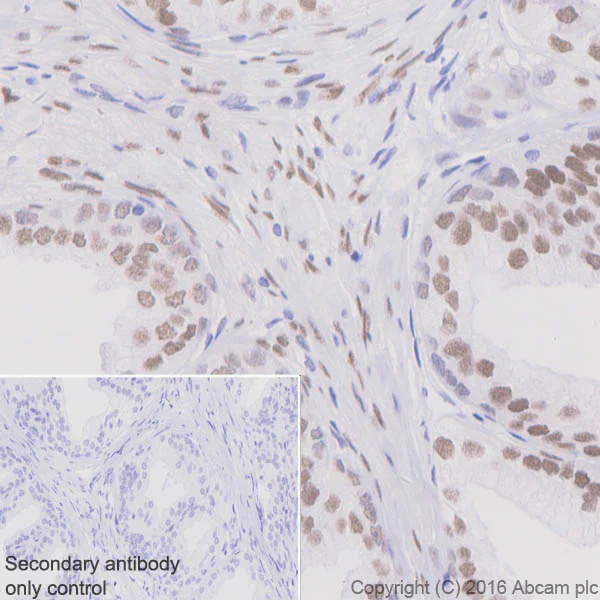 Immunohistochemistry (Formalin/PFA-fixed paraffin-embedded sections) - Anti-Androgen Receptor antibody [EPR1535(2)] - Low endotoxin, Azide free (AB209969)