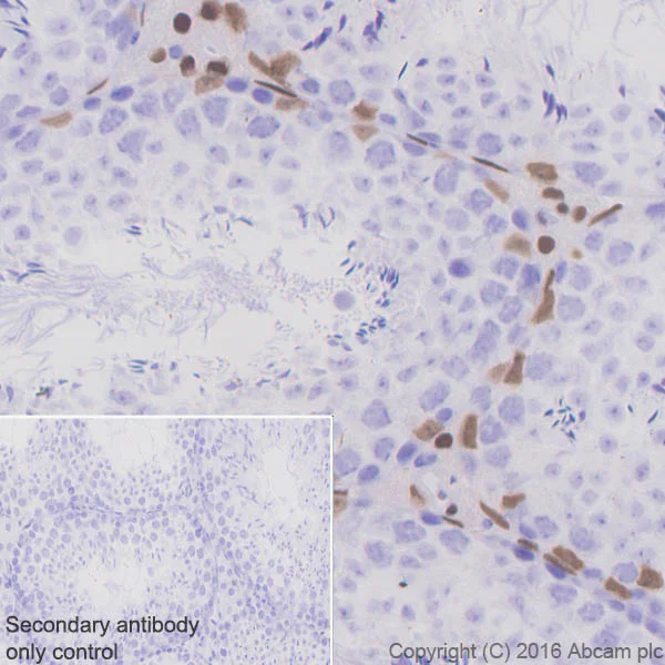 Immunohistochemistry (Formalin/PFA-fixed paraffin-embedded sections) - Anti-Androgen Receptor antibody [EPR1535(2)] - Low endotoxin, Azide free (AB209969)