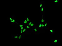 Immunocytochemistry/ Immunofluorescence - Anti-Androgen Receptor antibody [ER179(2)] - BSA and Azide free (AB212175)