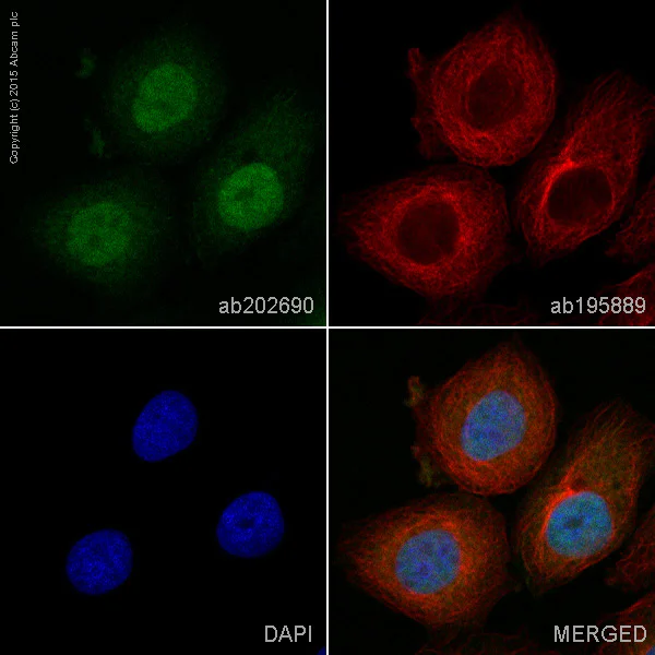 Immunocytochemistry/ Immunofluorescence - Anti-Androgen Receptor antibody [ER179(2)] - BSA and Azide free (AB212175)