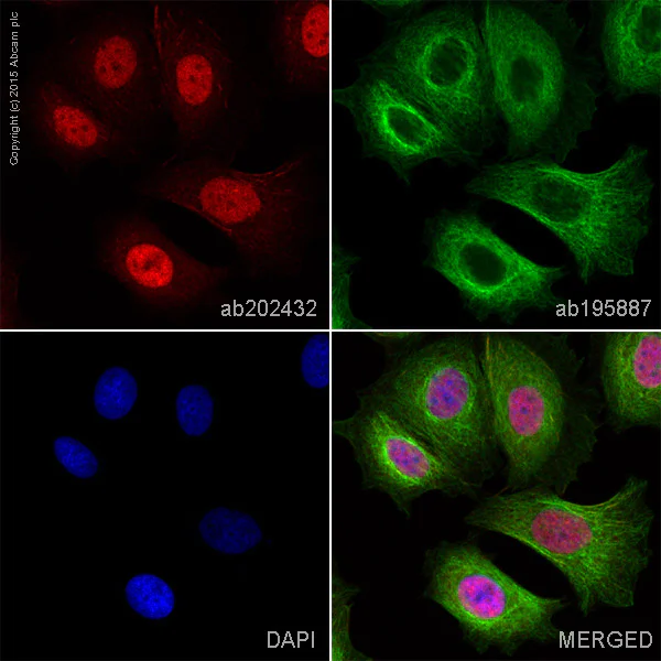 Immunocytochemistry/ Immunofluorescence - Anti-Androgen Receptor antibody [ER179(2)] - BSA and Azide free (AB212175)