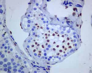Immunohistochemistry (Formalin/PFA-fixed paraffin-embedded sections) - Anti-Androgen Receptor antibody [ER179(2)] - BSA and Azide free (AB212175)