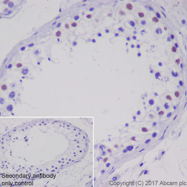 Immunohistochemistry (Formalin/PFA-fixed paraffin-embedded sections) - Anti-Androgen Receptor antibody [ER179(2)] - BSA and Azide free (AB212175)