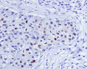 Immunohistochemistry (Formalin/PFA-fixed paraffin-embedded sections) - Anti-Androgen Receptor antibody [ER179(2)] - BSA and Azide free (AB212175)
