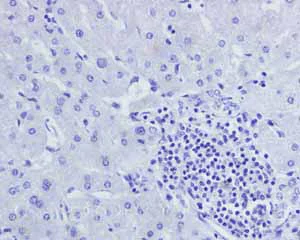 Immunohistochemistry (Formalin/PFA-fixed paraffin-embedded sections) - Anti-Androgen Receptor antibody [ER179(2)] - BSA and Azide free (AB212175)