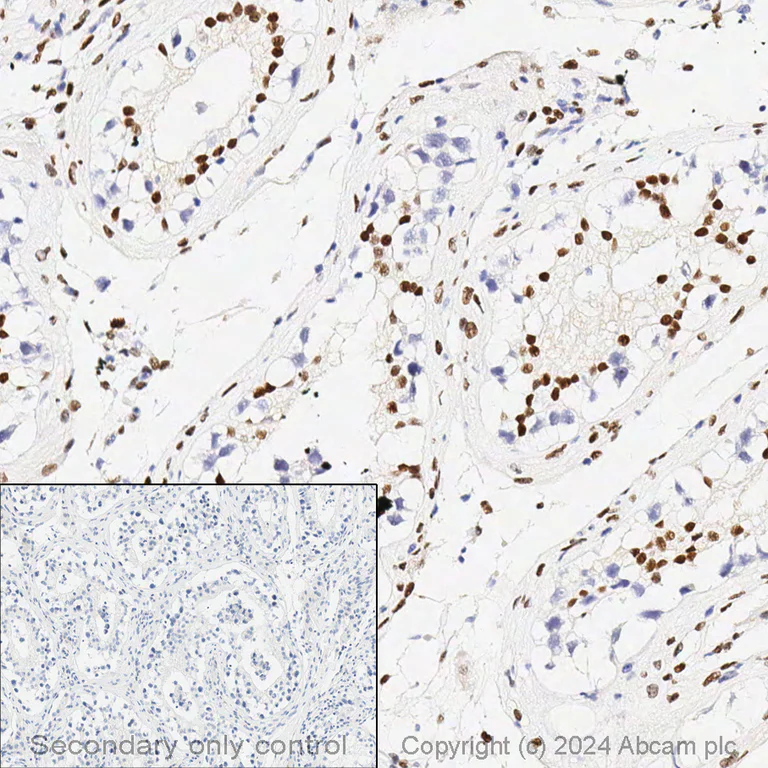 Immunohistochemistry - Anti-Androgen Receptor antibody [ER179(2)] - BSA and Azide free (AB212175)