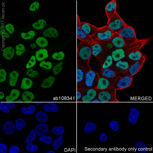 Immunocytochemistry/ Immunofluorescence - Anti-Androgen Receptor antibody [ER179(2)] - ChIP Grade (ab108341), expandable thumbnail