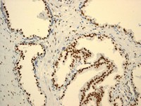 Immunohistochemistry (Formalin/PFA-fixed paraffin-embedded sections) - Anti-Androgen Receptor antibody [ER179(2)] - ChIP Grade (ab108341), expandable thumbnail