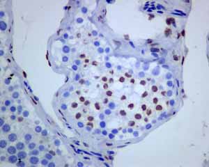 Immunohistochemistry (Formalin/PFA-fixed paraffin-embedded sections) - Anti-Androgen Receptor antibody [ER179(2)] - ChIP Grade (ab108341), expandable thumbnail