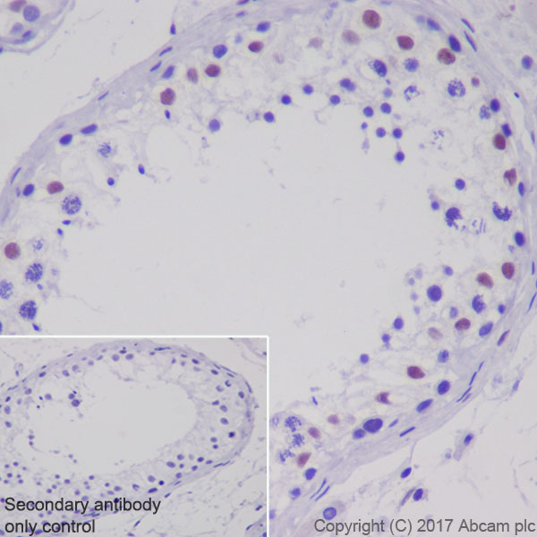 Immunohistochemistry (Formalin/PFA-fixed paraffin-embedded sections) - Anti-Androgen Receptor antibody [ER179(2)] - ChIP Grade (ab108341), expandable thumbnail