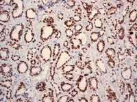 Immunohistochemistry (Formalin/PFA-fixed paraffin-embedded sections) - Anti-Androgen Receptor antibody [ER179(2)] - ChIP Grade (ab108341), expandable thumbnail