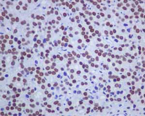 Immunohistochemistry (Formalin/PFA-fixed paraffin-embedded sections) - Anti-Androgen Receptor antibody [ER179(2)] - ChIP Grade (ab108341), expandable thumbnail