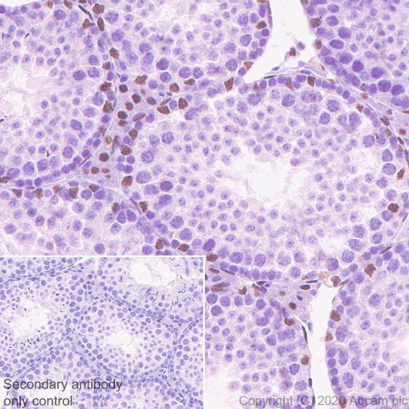 Immunohistochemistry (Formalin/PFA-fixed paraffin-embedded sections) - Anti-Androgen Receptor antibody [ER179(2)] - ChIP Grade (AB108341), expandable thumbnail