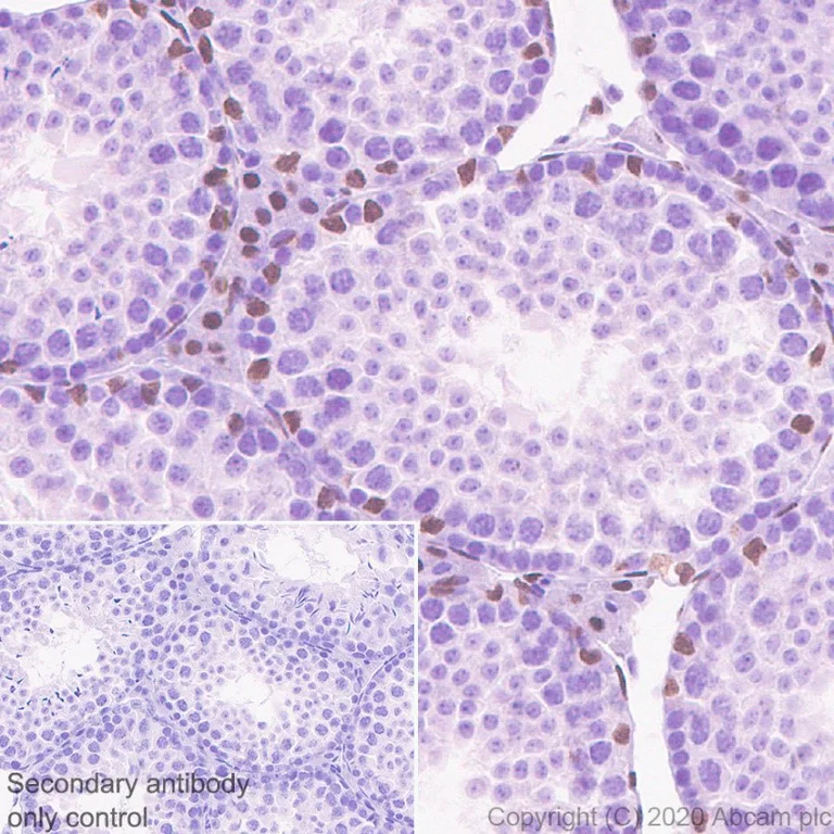 Immunohistochemistry (Formalin/PFA-fixed paraffin-embedded sections) - Anti-Androgen Receptor antibody [ER179(2)] - ChIP Grade (AB108341)