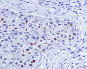 Immunohistochemistry (Formalin/PFA-fixed paraffin-embedded sections) - Anti-Androgen Receptor antibody [ER179(2)] - ChIP Grade (ab108341), expandable thumbnail