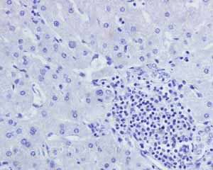Immunohistochemistry (Formalin/PFA-fixed paraffin-embedded sections) - Anti-Androgen Receptor antibody [ER179(2)] - ChIP Grade (ab108341), expandable thumbnail