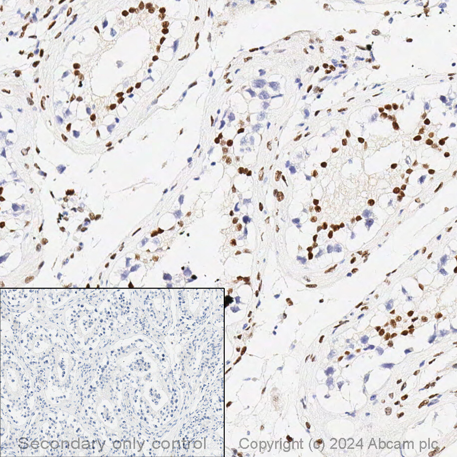 Immunohistochemistry - Anti-Androgen Receptor antibody [ER179(2)] - ChIP Grade (AB108341), expandable thumbnail