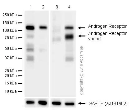 Western blot - Anti-Androgen Receptor antibody [ER179(2)] - ChIP Grade (AB108341)