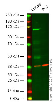 Western blot - Anti-Androgen Receptor antibody [ER179(2)] - ChIP Grade (ab108341), expandable thumbnail