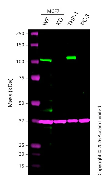 Western blot - Anti-Androgen Receptor antibody [ER179(2)] - ChIP Grade (AB108341)