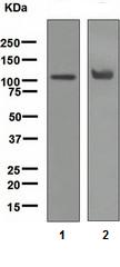Western blot - Anti-Androgen Receptor antibody [ER179(2)] - ChIP Grade (ab108341), expandable thumbnail