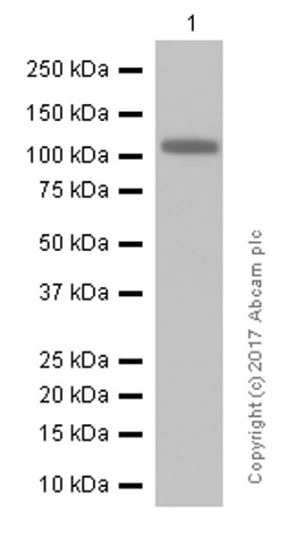 Western blot - Anti-Androgen Receptor antibody [ER179(2)] - ChIP Grade (ab108341), expandable thumbnail