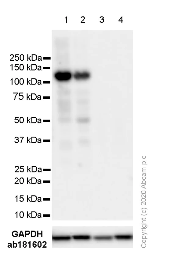 Western blot - Anti-Androgen Receptor antibody [ER179(2)] - ChIP Grade (AB108341)