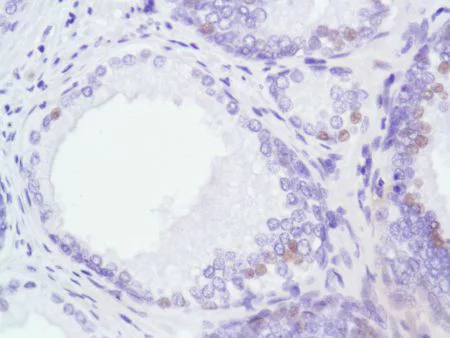 Immunohistochemistry (Formalin/PFA-fixed paraffin-embedded sections) - Anti-Androgen Receptor antibody [SP107] - BSA and Azide free (AB236225)