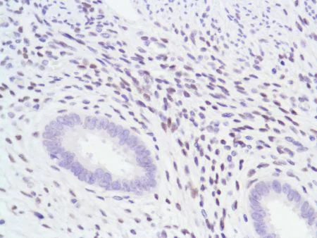 Immunohistochemistry (Formalin/PFA-fixed paraffin-embedded sections) - Anti-Androgen Receptor antibody [SP107] - BSA and Azide free (AB236225)
