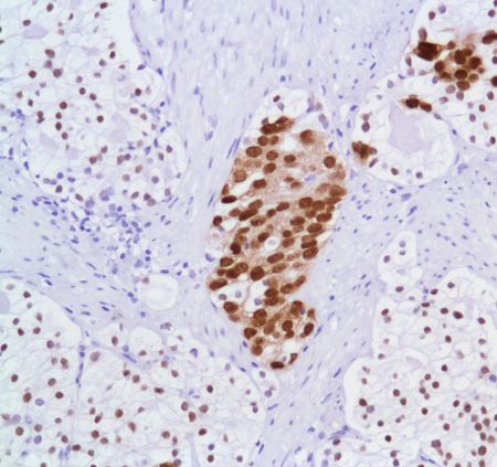 Immunohistochemistry (Formalin/PFA-fixed paraffin-embedded sections) - Anti-Androgen Receptor antibody [SP107] - BSA and Azide free (AB236225), expandable thumbnail