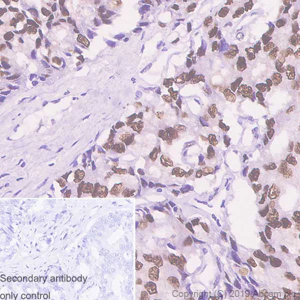 Immunohistochemistry (Formalin/PFA-fixed paraffin-embedded sections) - Anti-Androgen Receptor antibody [SP107] - BSA and Azide free (AB236225)