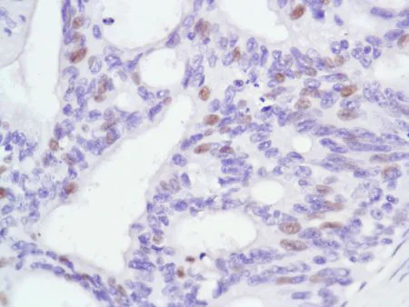 Immunohistochemistry (Formalin/PFA-fixed paraffin-embedded sections) - Anti-Androgen Receptor antibody [SP107] - BSA and Azide free (AB236225)